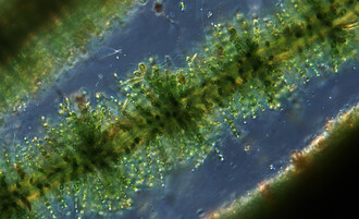 Mikroskopický snímek ruduchy (červené řasy) rodu Batrachospermum.